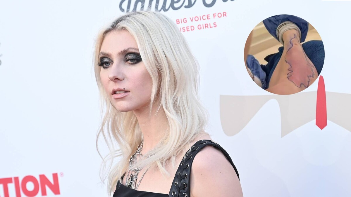 Taylor Momsen Hospitalized After Spider Bite in Mexico