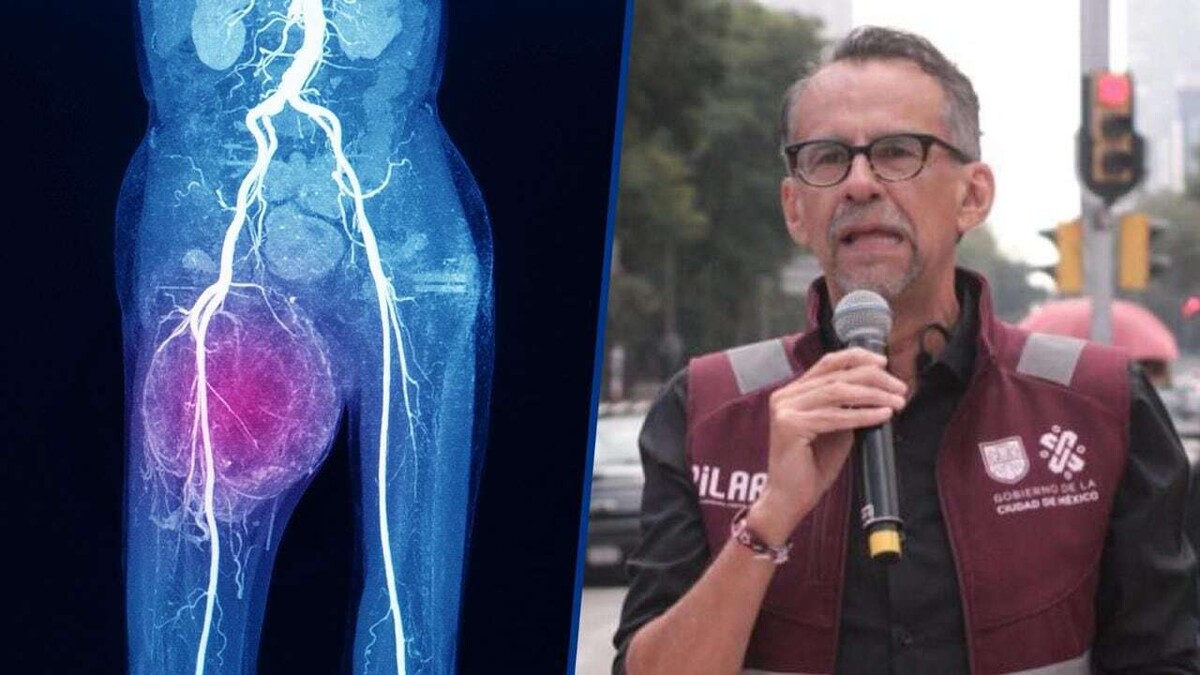 Former Director of the Sports Institute of Mexico Reveals Sarcoma Diagnosis