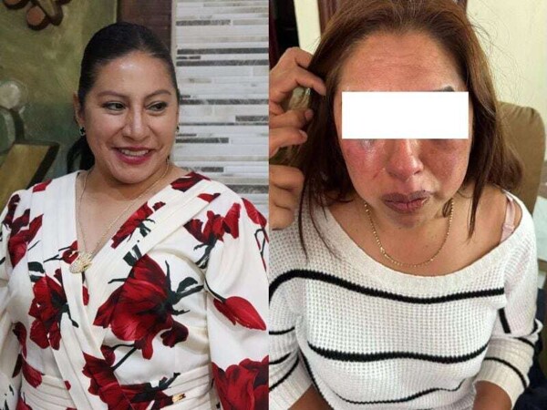 Capulhuac Mayor Accused of Assaulting Municipal Employee