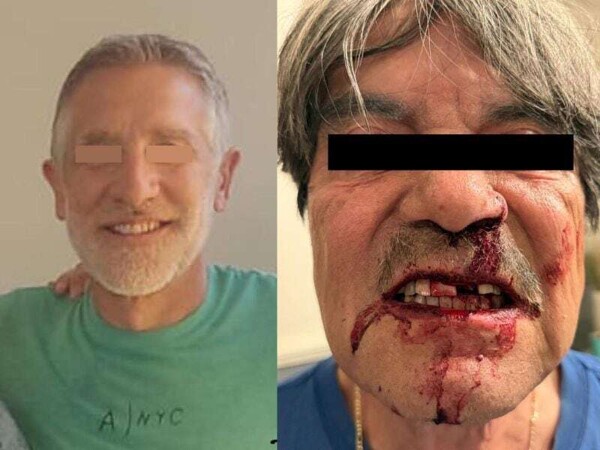 Elderly Scientist Assaulted in Irapuato