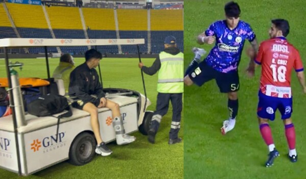 Kevin Álvarez suffers ankle sprain during match