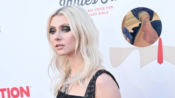 Taylor Momsen Hospitalized After Spider Bite in Mexico