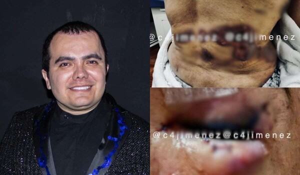 Controversy Surrounds 'Doctor Gama' in Mexico